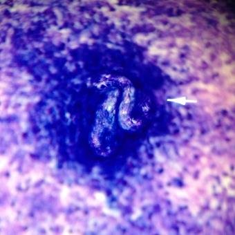 Aelurostrongylose pulmonaire du chat