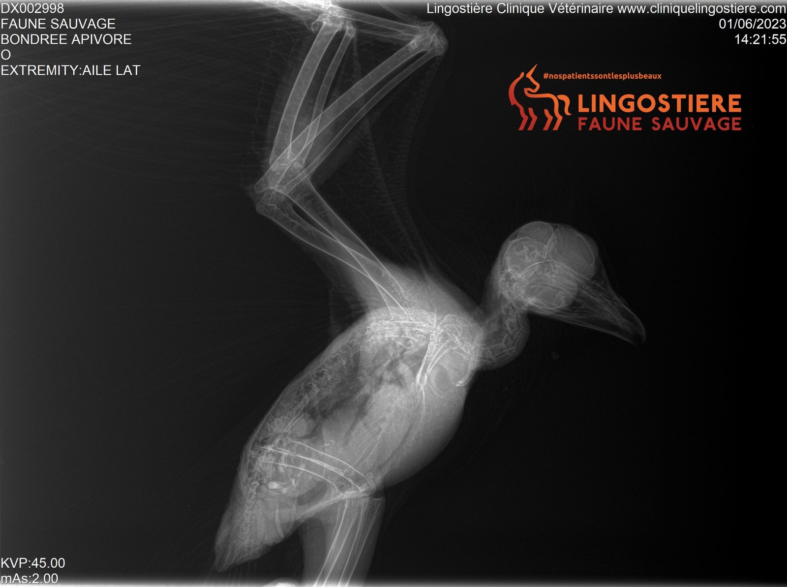 Radiographie Bondrée 2