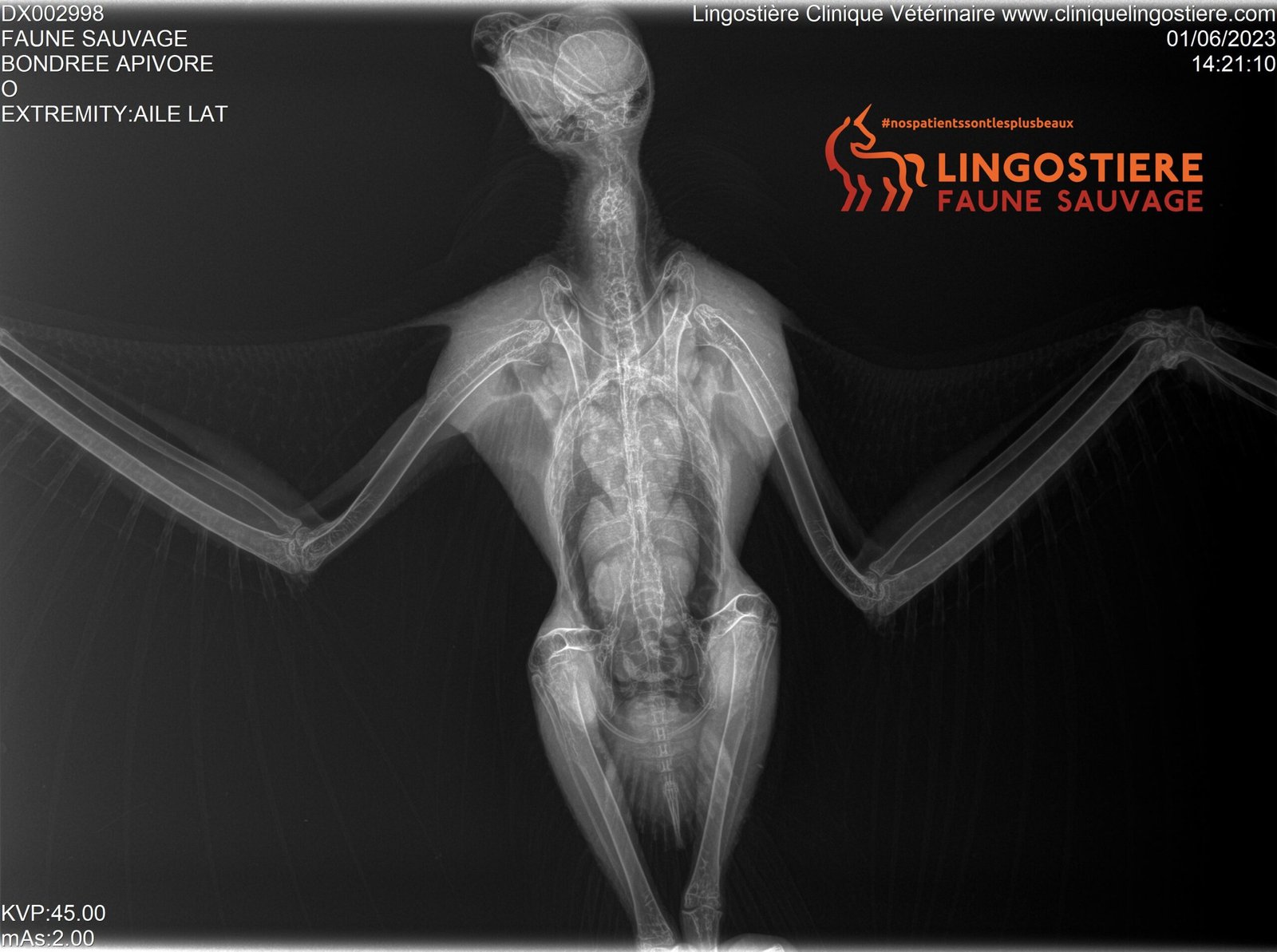 Radiographie Bondrée 1