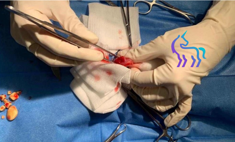 Retrait calculs furet