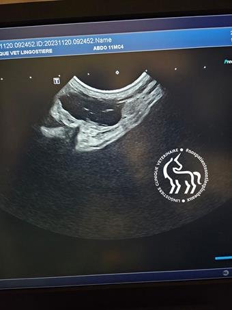 Kyste ovarien échographie