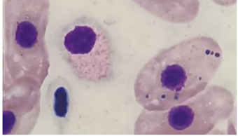 Erythrocyte requin avec inclusion basophile