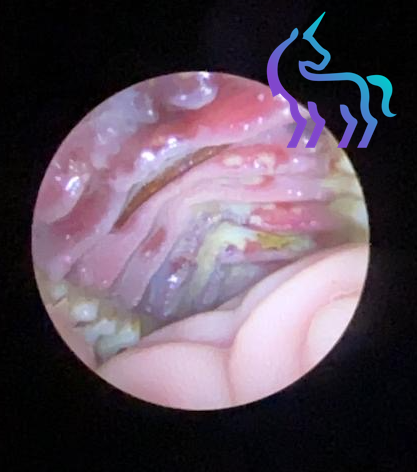 Infection buccale wallaby