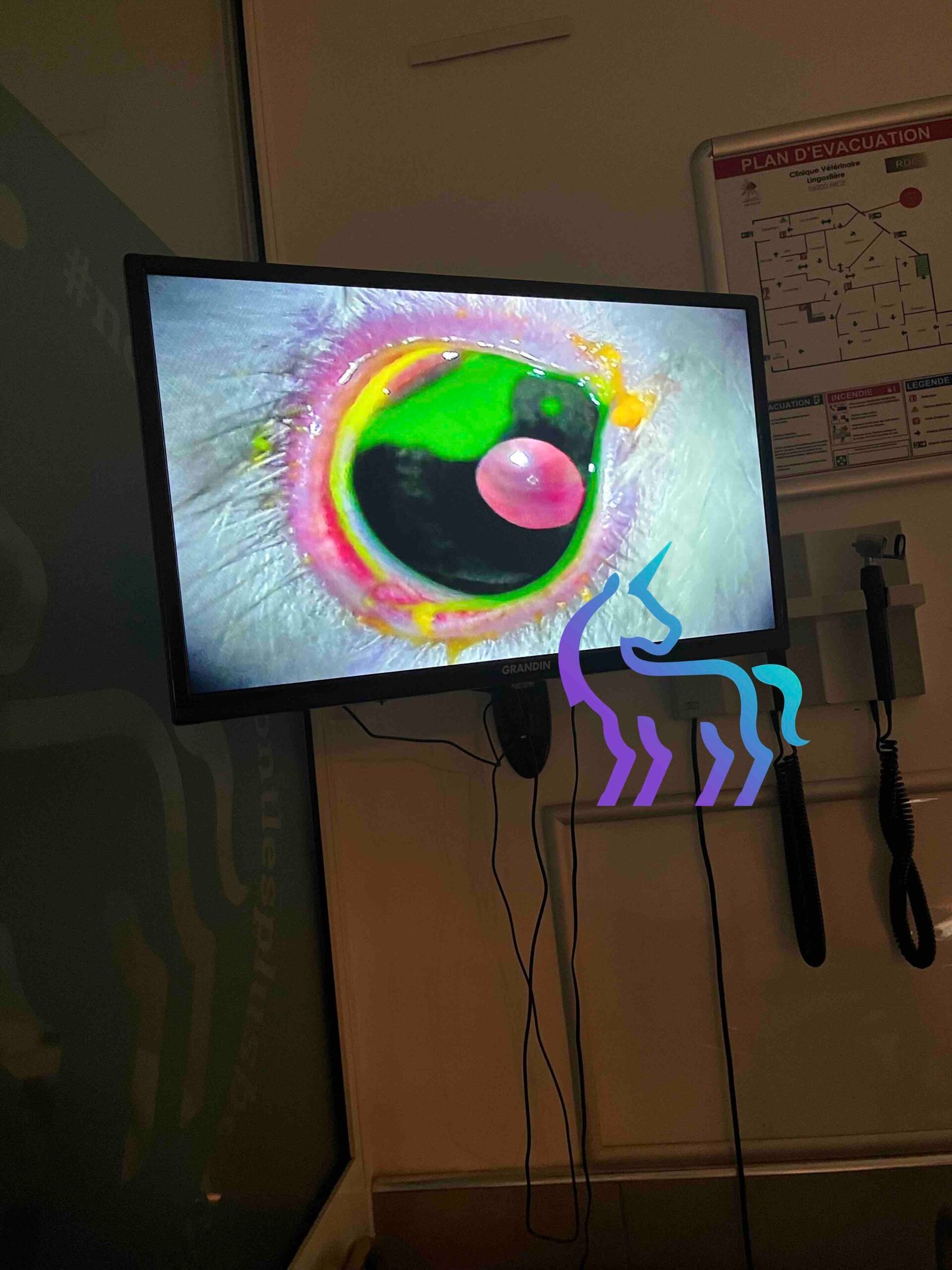 Ulcère cornéen furet test fluorescéine - Clinique Lingostière Nice