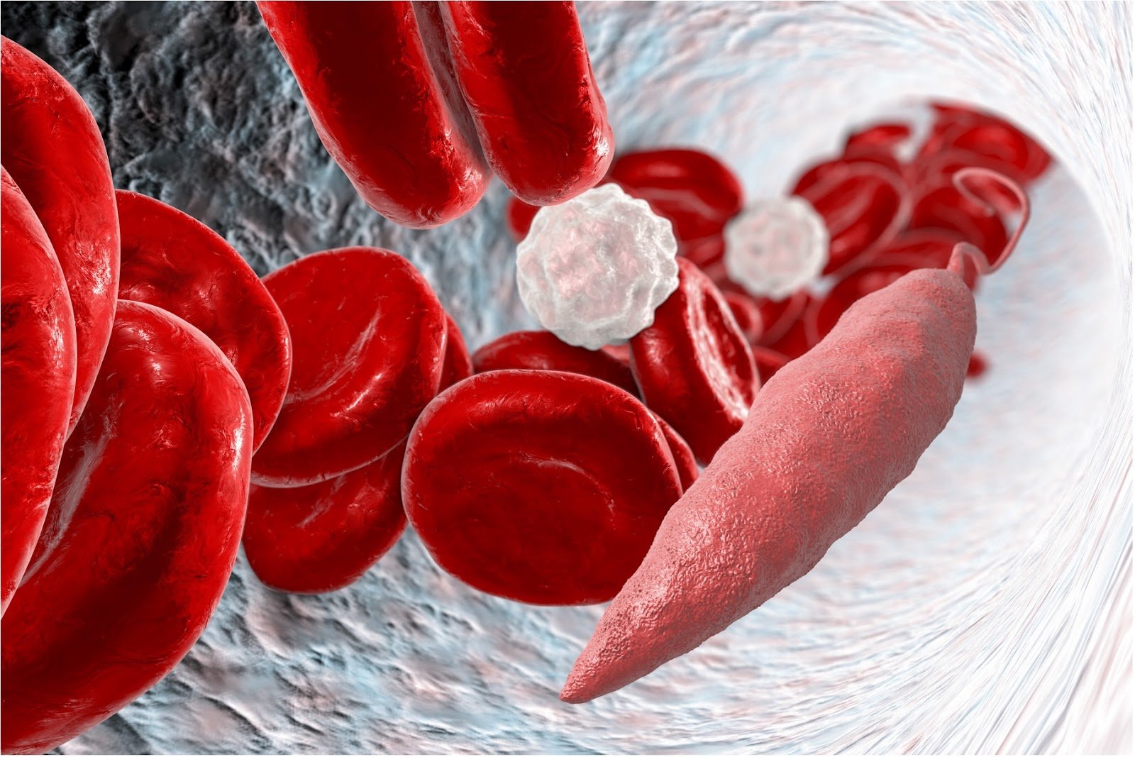 Indicateurs de pronostic