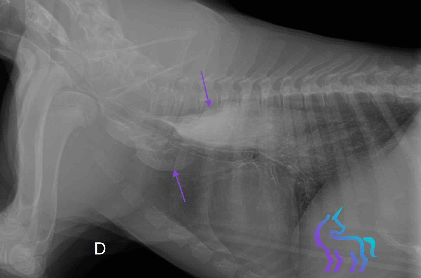 Radiographie avec produit de contraste confirmant le mégaœsophage