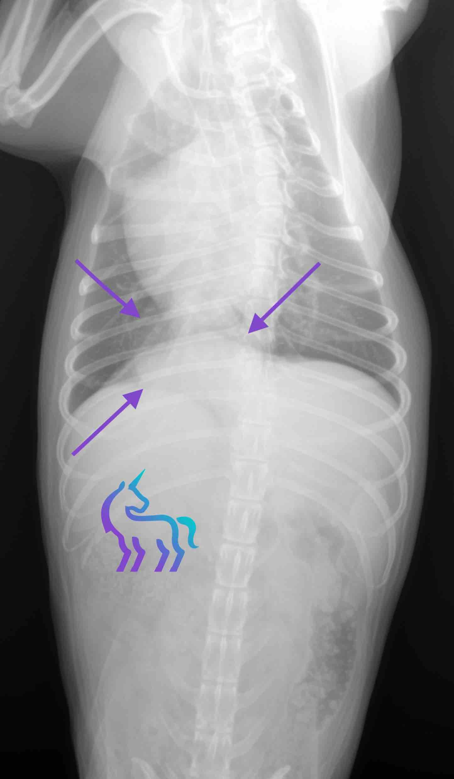 Visualisation de la masse de 5cm dans le lobe caudal droit