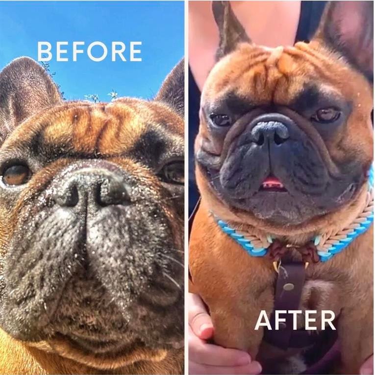 Chirurgie du voile du palais