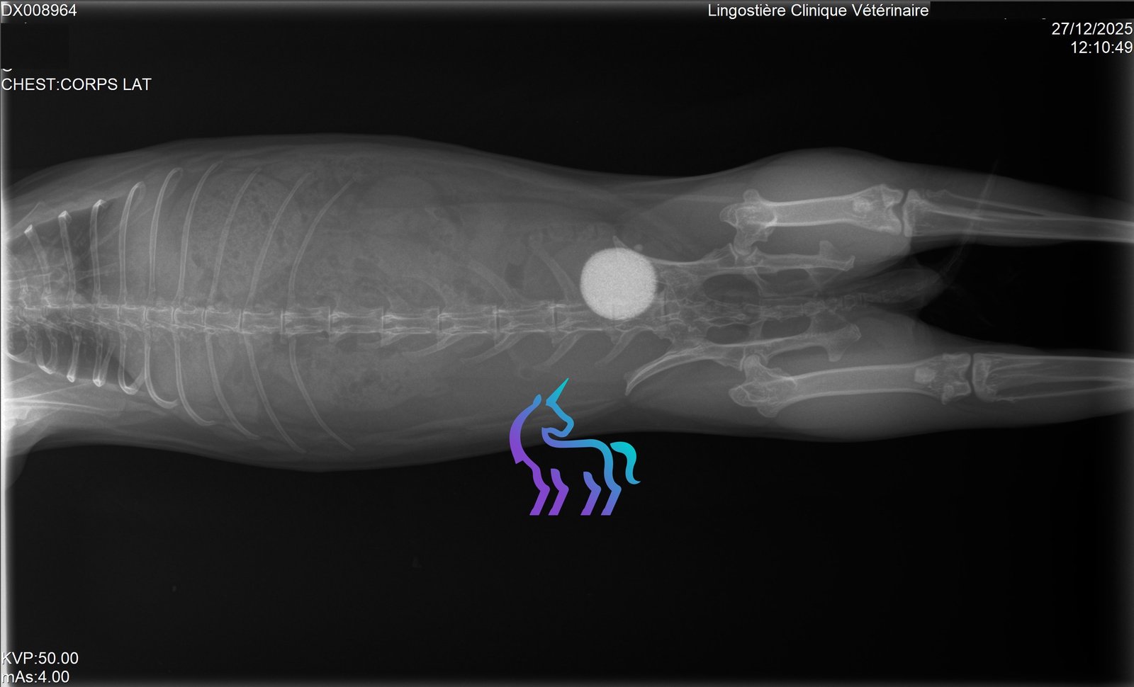 Radio calcul vessie 2