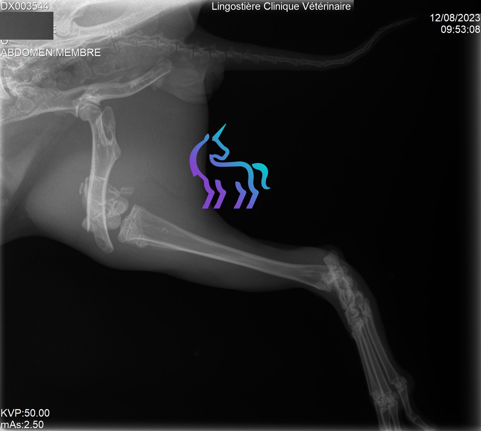 Radio fracture fémur