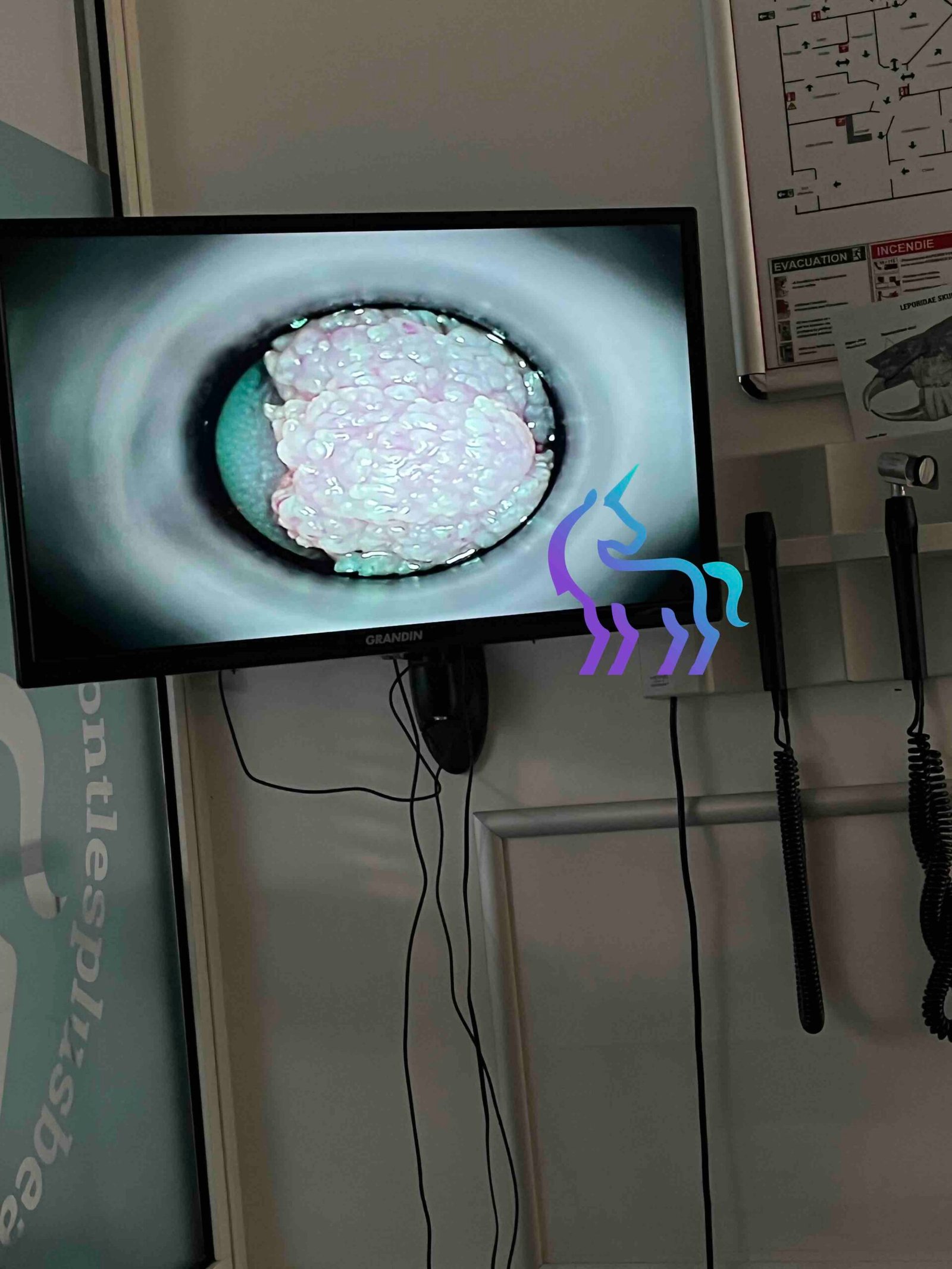 Visualisation papillome bouche lapin - Vidéo-otoscopie