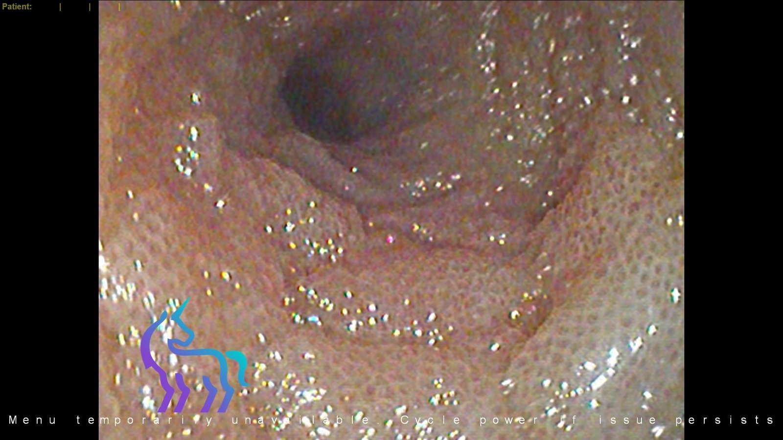 Endoscopie digestive chien - Entéropathie chronique