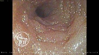 Entéropathie chronique chien - Dr Ghislain