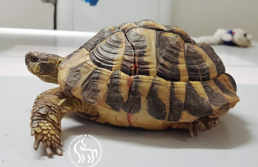 Fracture complexe stabilisée par le Dr Martinez