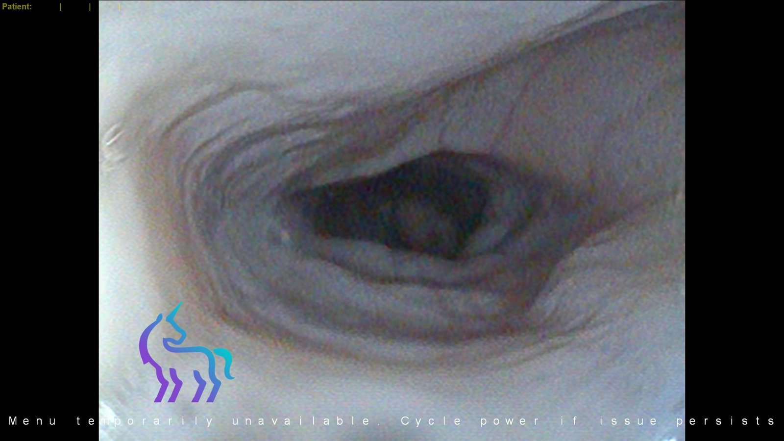 Endoscopie œsophage chien - Muqueuse d'aspect normal