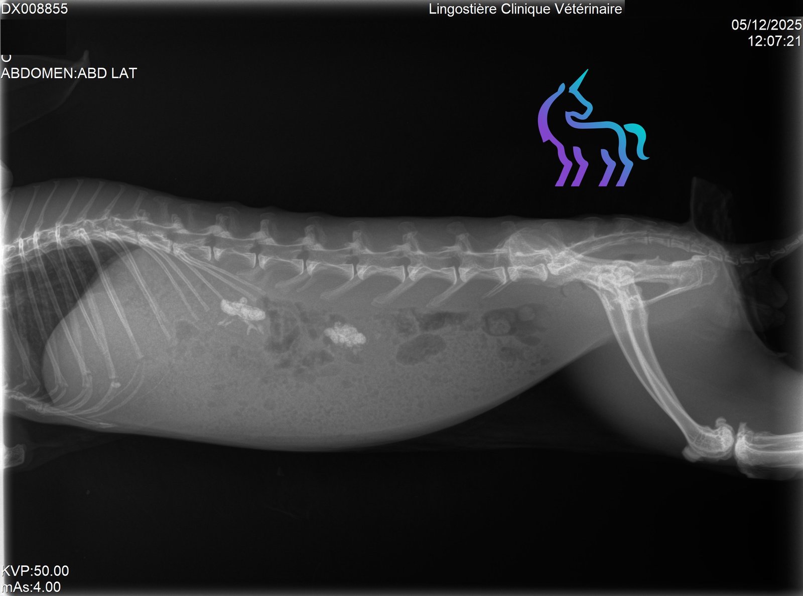Radio calcul rénal 1