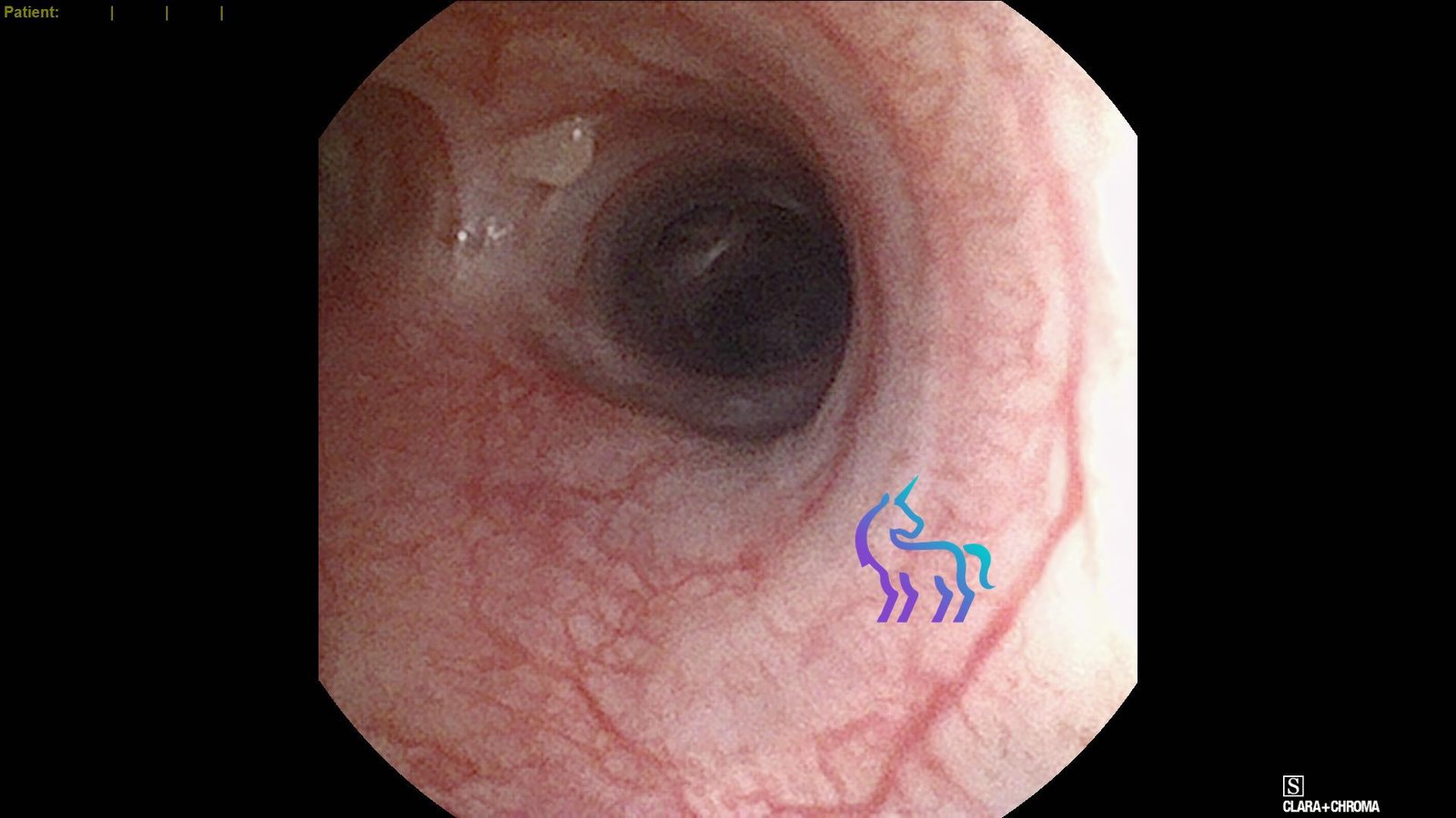 Imagerie et Endoscopie