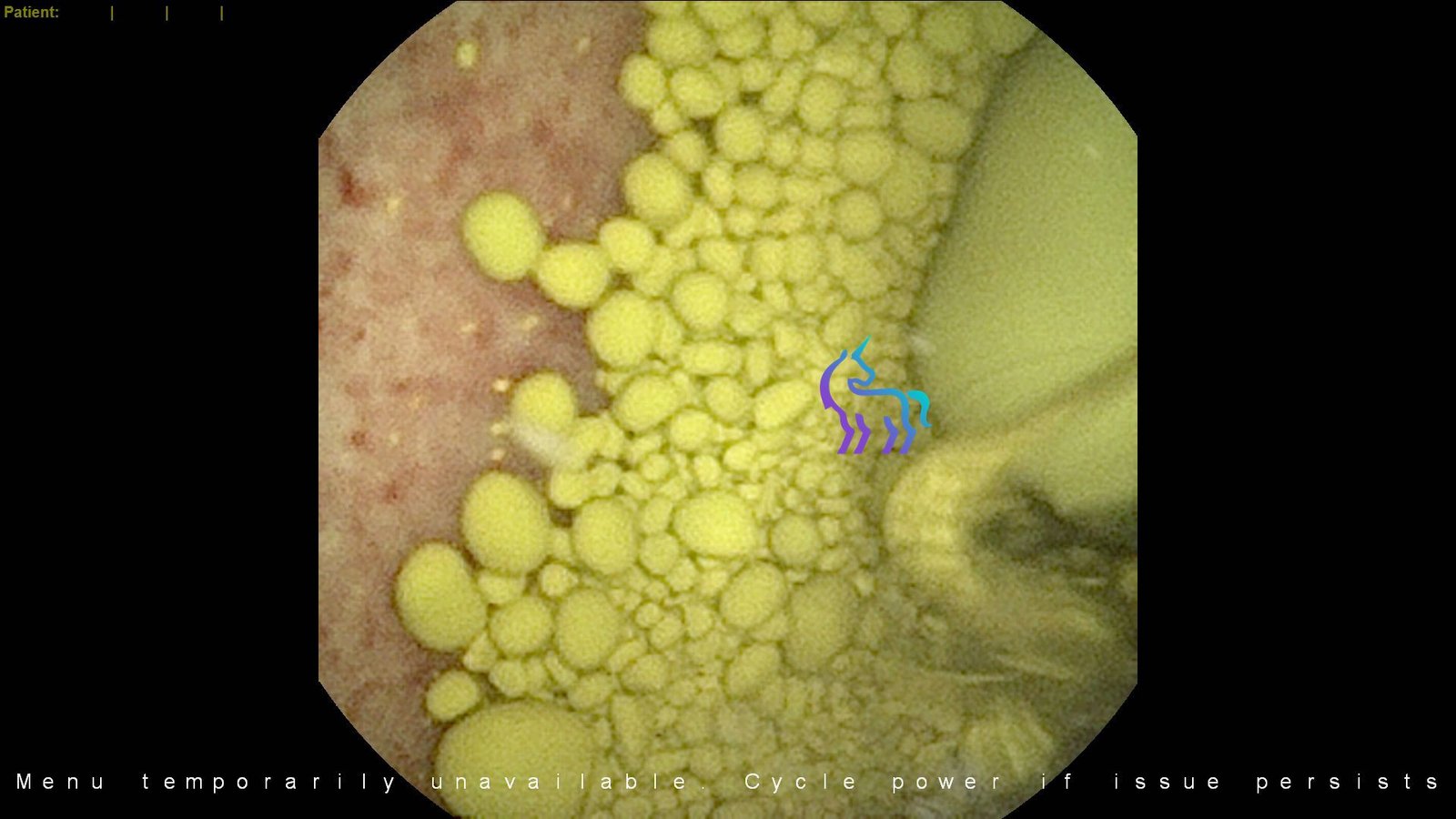 Fibroscopie vessie chien calcul xanthine allopurinol